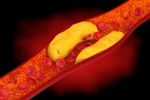 Healthy cholesterol ratio showing HDL and LDL balance in arteries