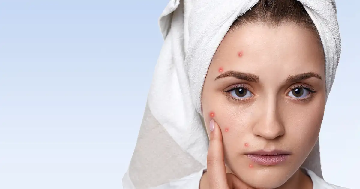 Woman looking at hair loss in brush — hormonal hair loss in women