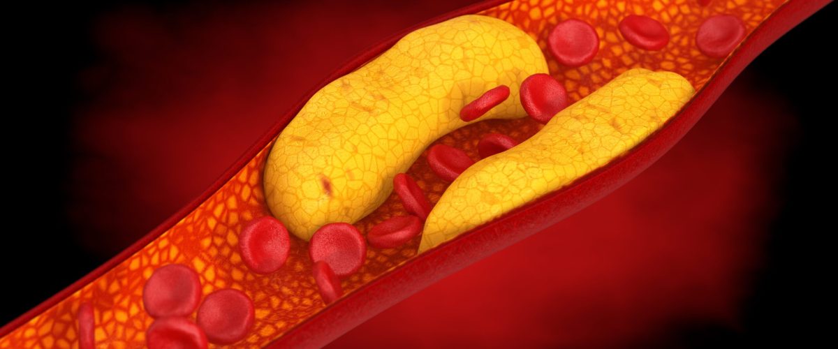Healthy cholesterol ratio showing HDL and LDL balance in arteries